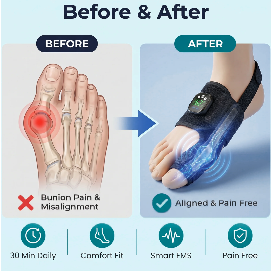 ToeShape Corrector-EMS Bunion Corrector