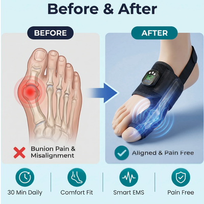 ToeShape-EMS Bunion Corrector