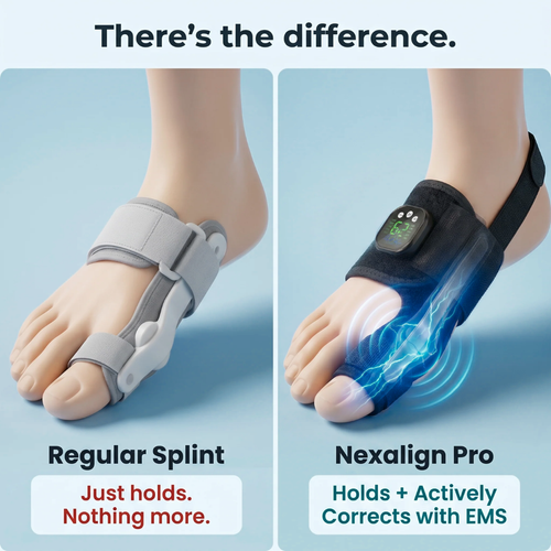 ToeShape-EMS Bunion Corrector