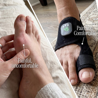 ToeShape-EMS Bunion Corrector